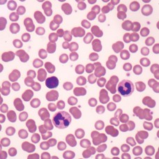 Human Blood Film Slide, Smear, H&E Stain